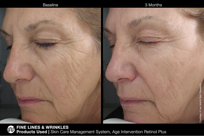 Jan Marini Retinol Set ZESTAW Przeciwstarzeniowy krem z retinolem 28 g + Maska z retinolem 34,5 g