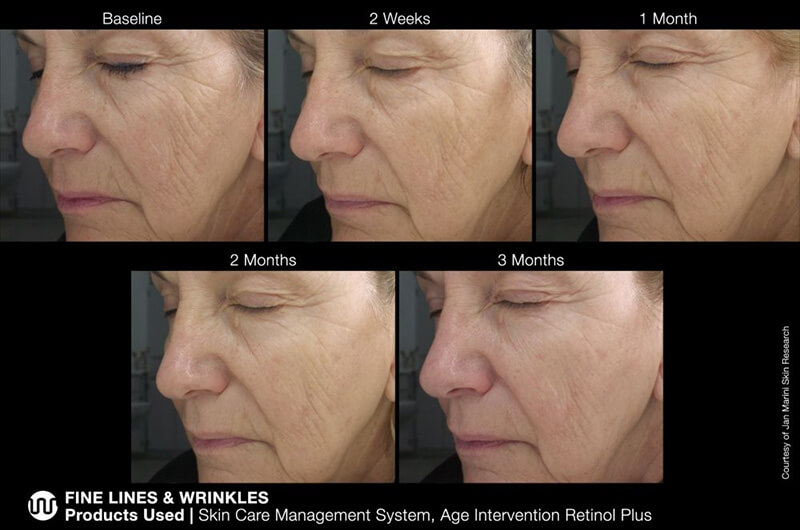 Jan Marini Retinol Set ZESTAW Przeciwstarzeniowy krem z retinolem 28 g + Maska z retinolem 34,5 g