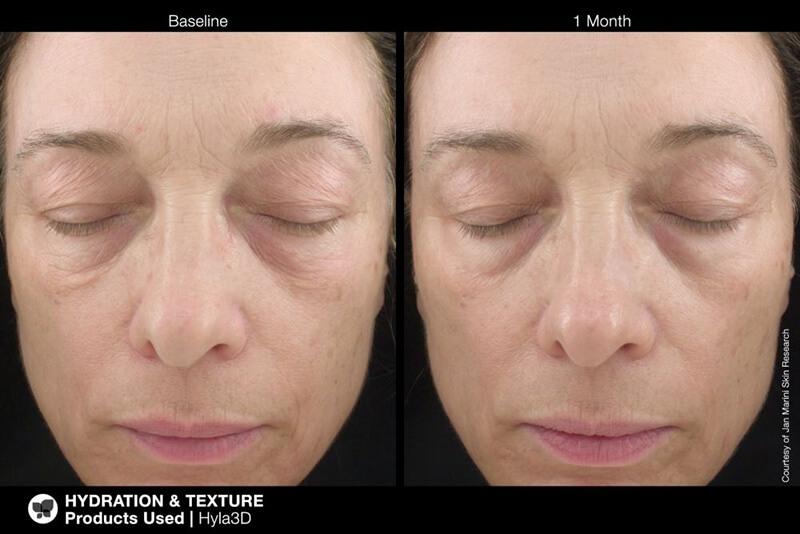 Jan Marini Hyla3D® Face Serum Serum rewitalizujące 30 ml