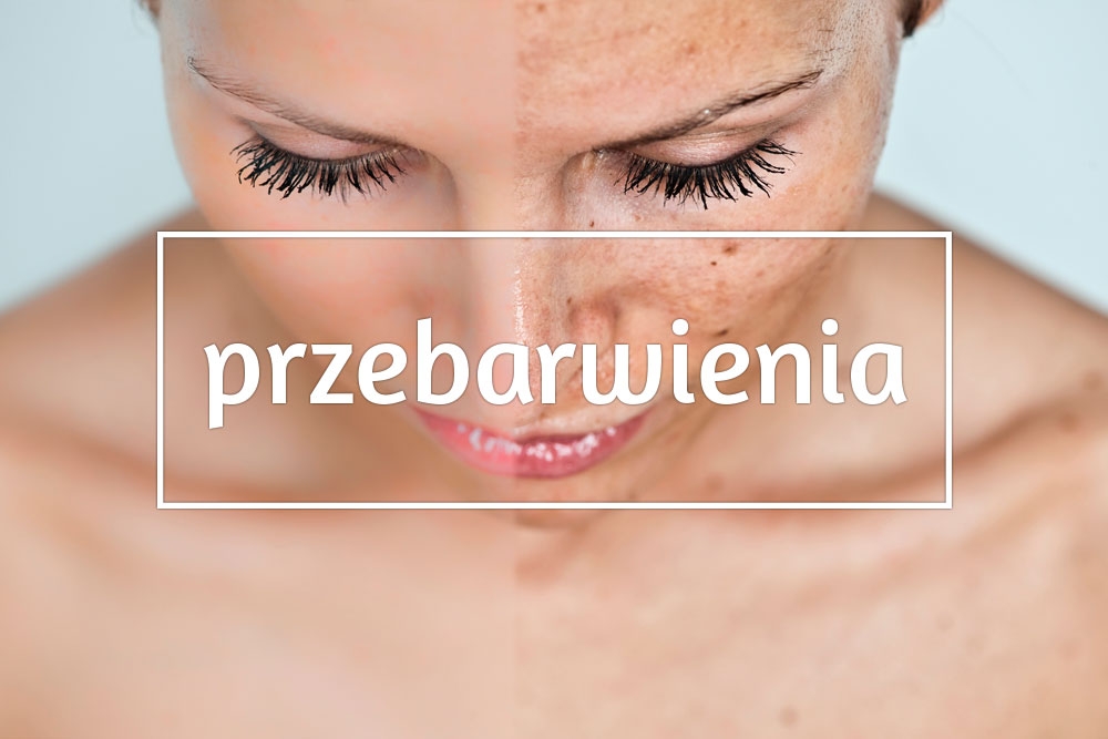 Przebarwienia