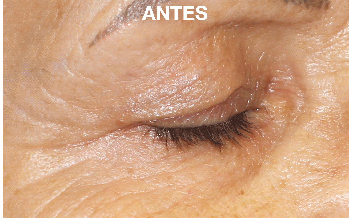 Germaine de Capuccini Eye Contour Global Treatment + Global Cream Wrinkles Rich ZESTAW Pielęgnacja przeciwzmarszczkowa oczu 2 x 10 ml + Krem przeciwzmarszczkowy 15 ml