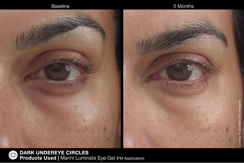 Jan Marini Marini Luminate Eye Gel Żel rozjaśniający do pielęgnacji okolic oczu 15 ml