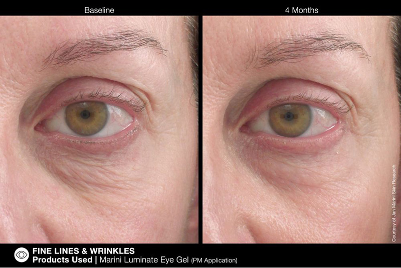 Jan Marini Marini Luminate Eye Gel Żel rozjaśniający do pielęgnacji okolic oczu 15 ml