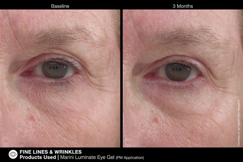 Jan Marini Marini Luminate Eye Gel Żel rozjaśniający do pielęgnacji okolic oczu 15 ml