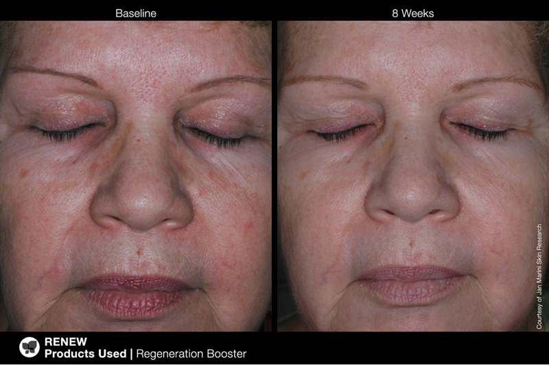 Jan Marini Regeneration Booster Booster regenerujący 30 ml