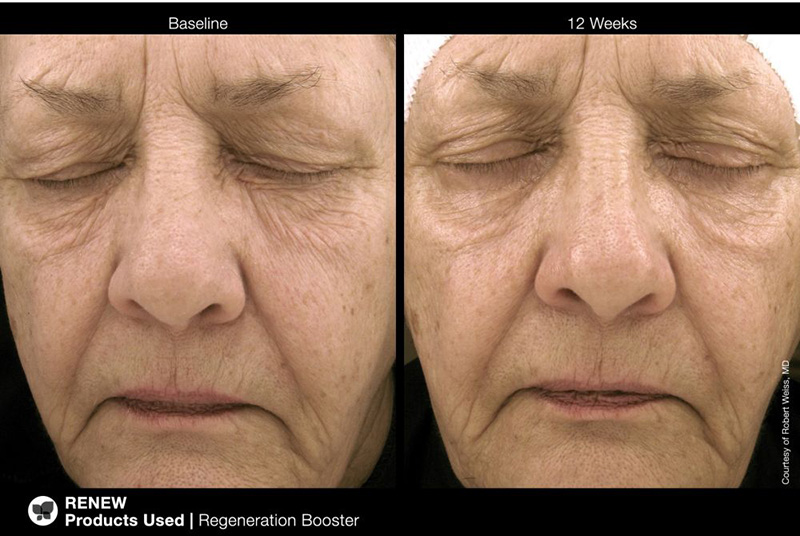 Jan Marini Regeneration Booster Booster regenerujący 30 ml