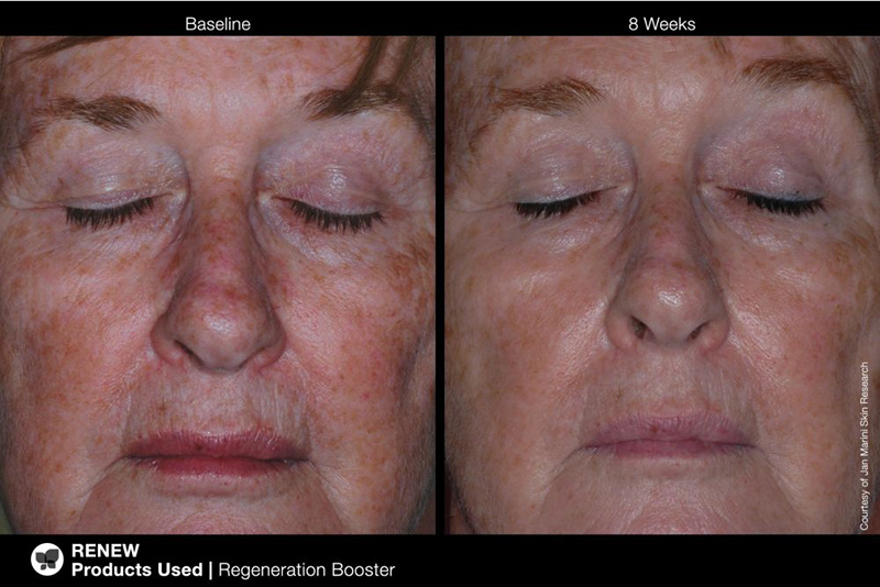 Jan Marini Regeneration Booster Booster regenerujący 30 ml