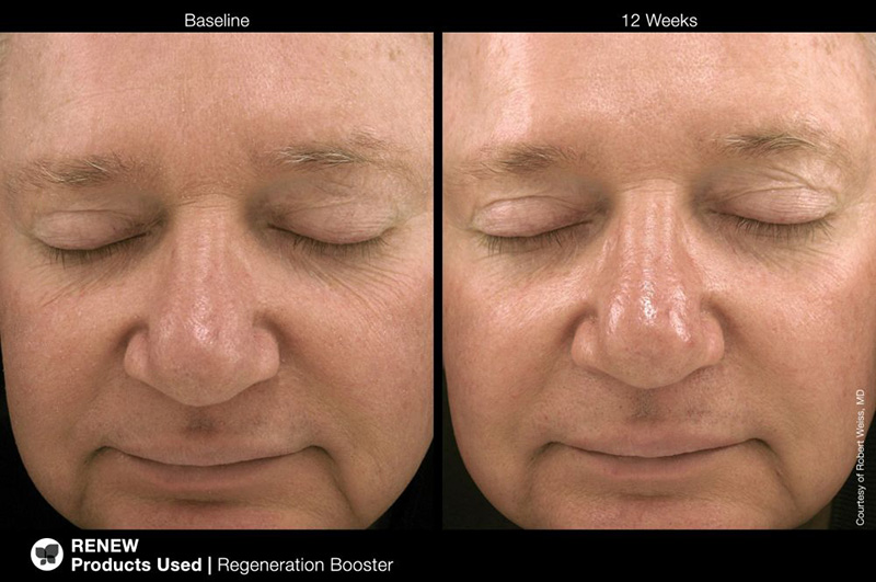 Jan Marini Regeneration Booster Booster regenerujący 30 ml