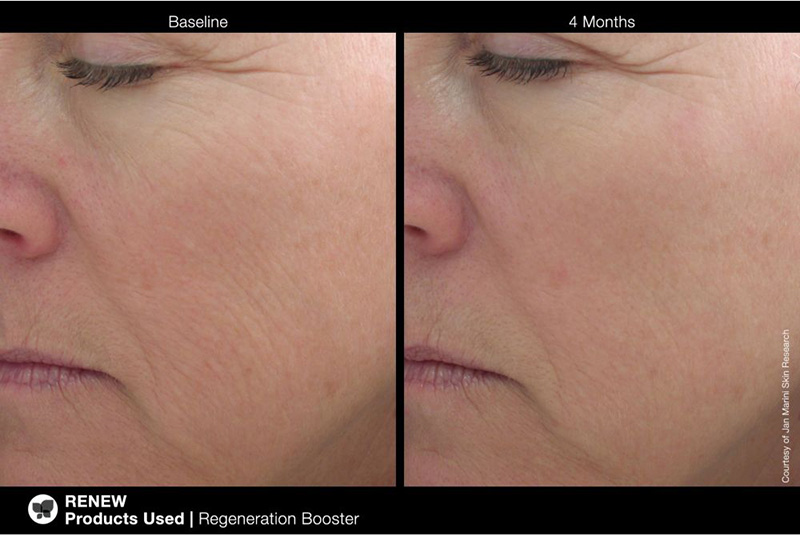 Jan Marini Regeneration Booster Booster regenerujący 30 ml