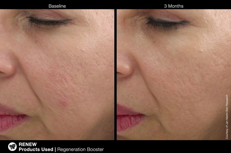 Jan Marini Regeneration Booster Booster regenerujący 30 ml