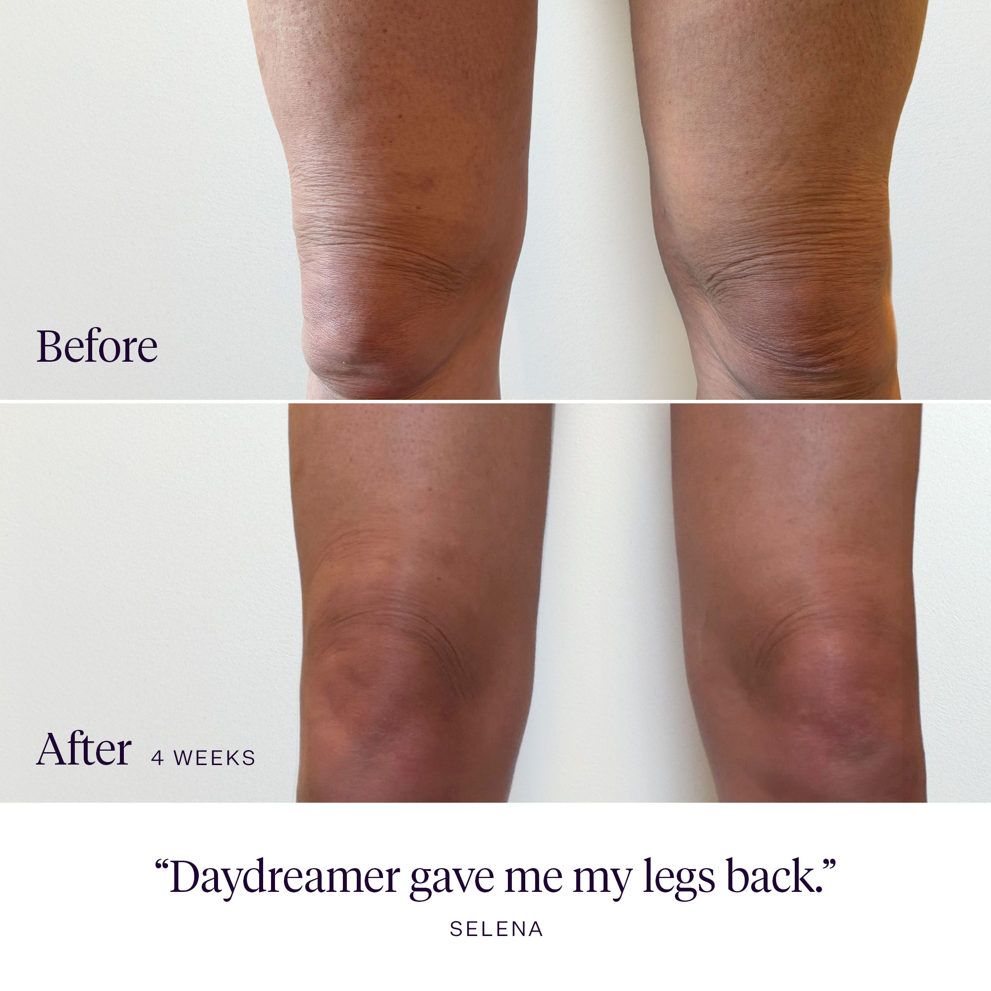 Joonbyrd Daydreamer Body Serum Ujędrniające serum do ciała o nutach zapachowych piżma, bursztynu, drzewa gwajakowego, jaśminu i karmelu 15 ml